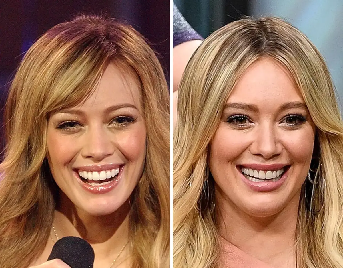 celebrity smiles at wetaskiwin family dental