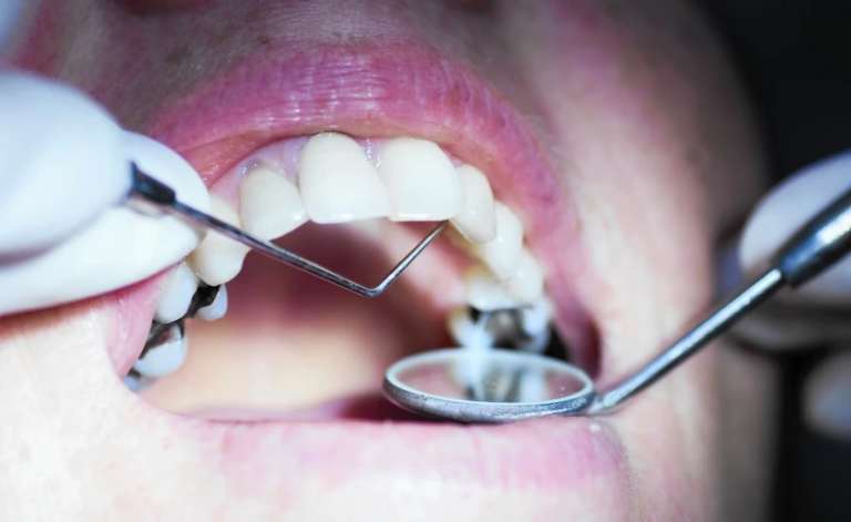 do you have the most common dental problem