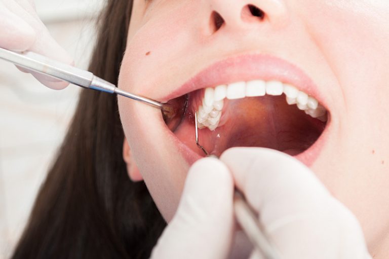 how much do you know about gum disease