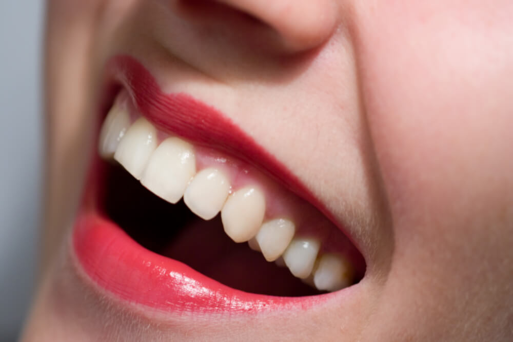 tooth whitening and your dentist