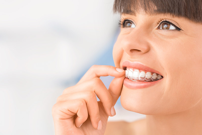 invisalign in wetaskiwin