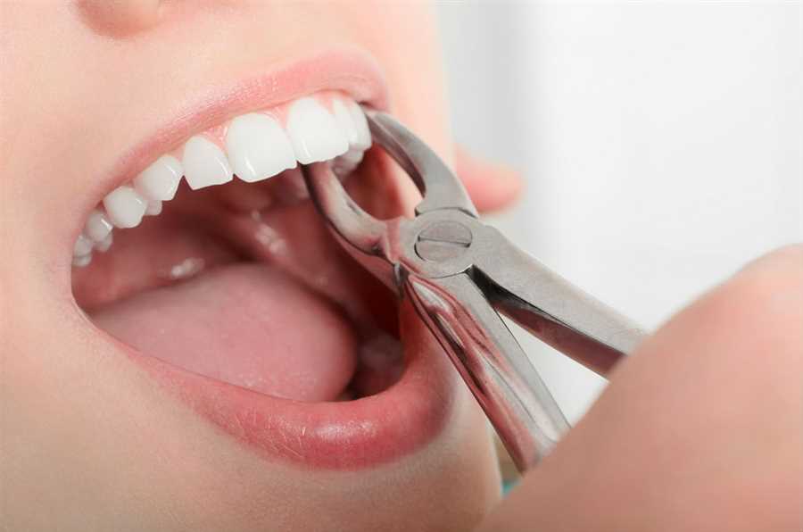 tooth extraction in wetaskiwin