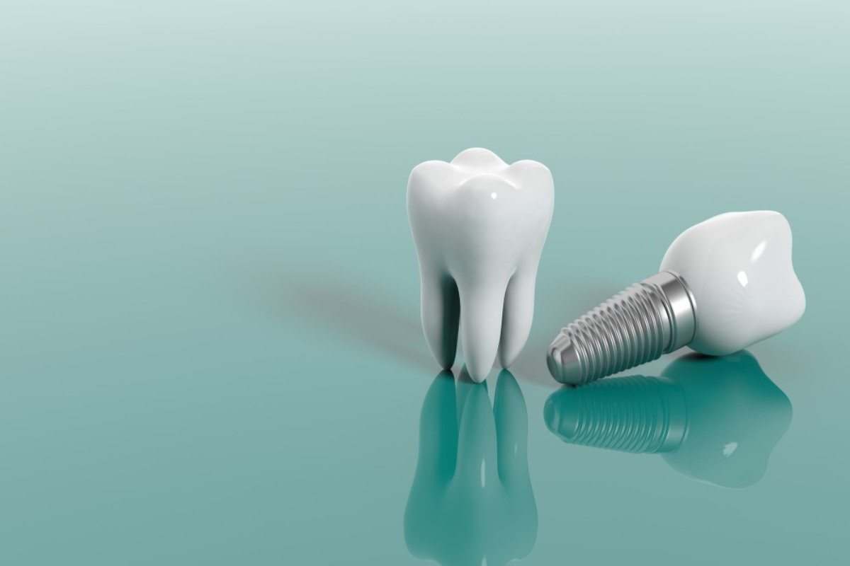 how do you take care of dental implants