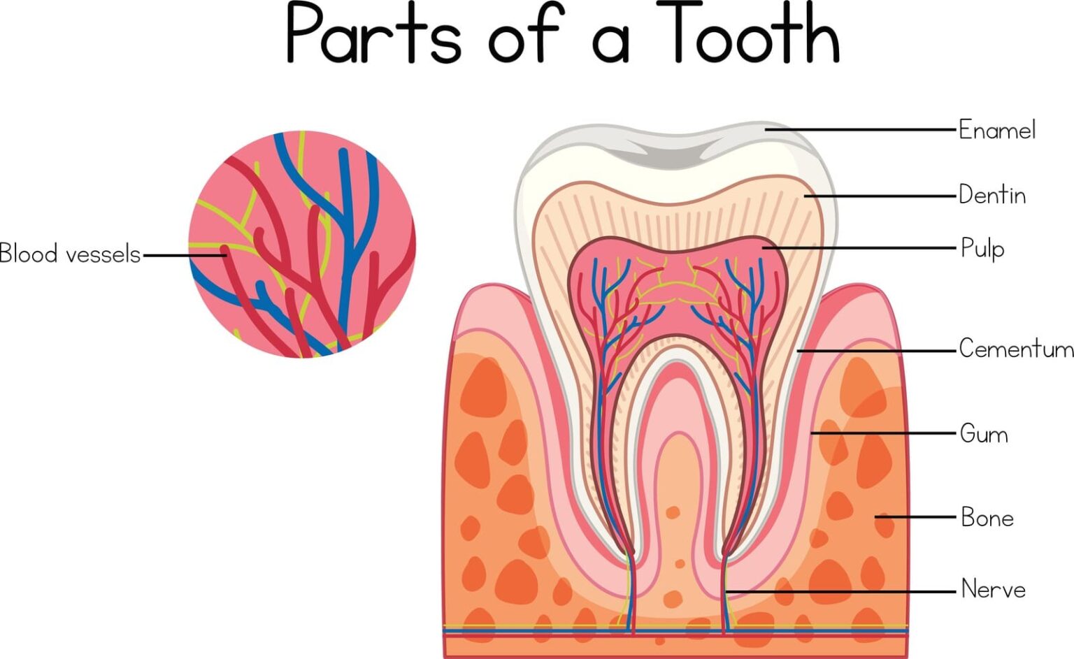 when do you need an emergency root canal