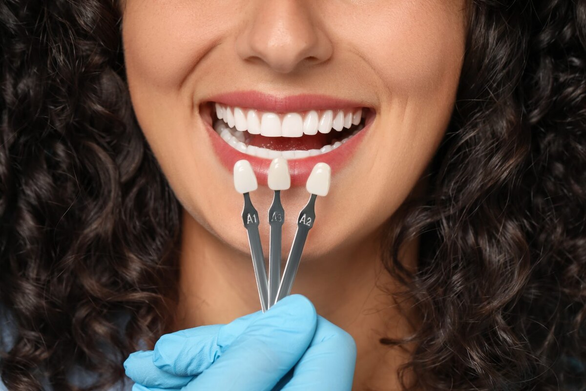 what to know about getting porcelain veneers